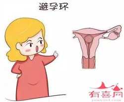 云南助孕助孕宝,2023年云南省试管婴儿价格贵吗？附最新助孕费用明细一览